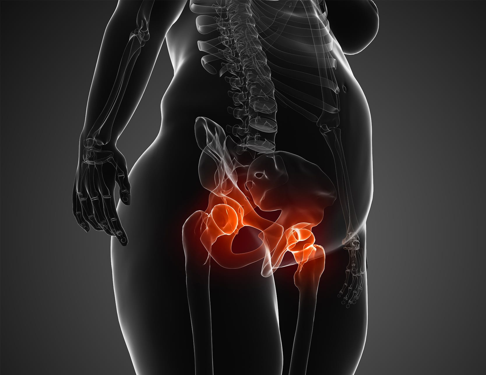 Prothèse de hanche et obésité : nos recommandations | Paris | Inside the Hip