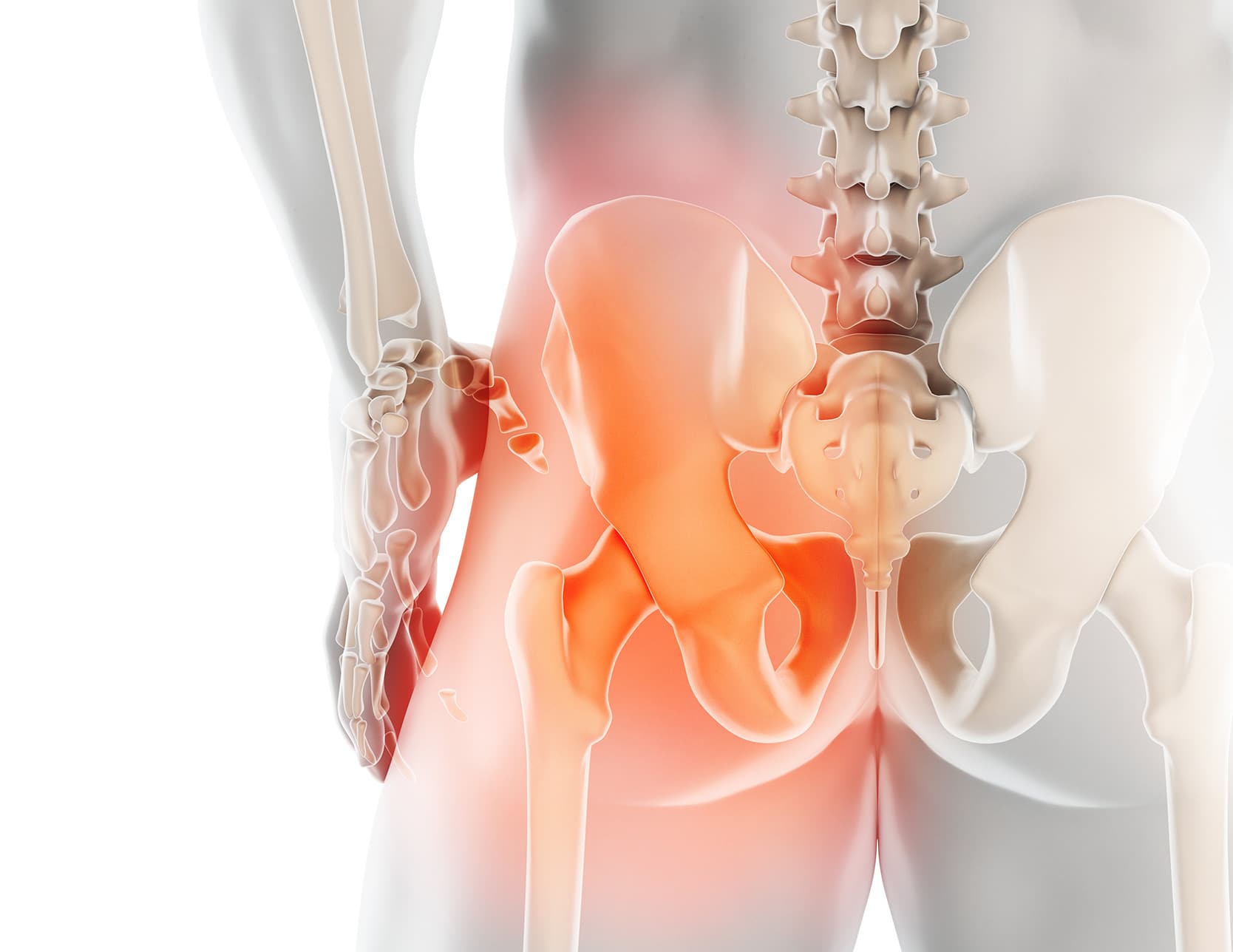 Ostéotomie périacétabulaire : causes et technique à Paris | Inside the Hip