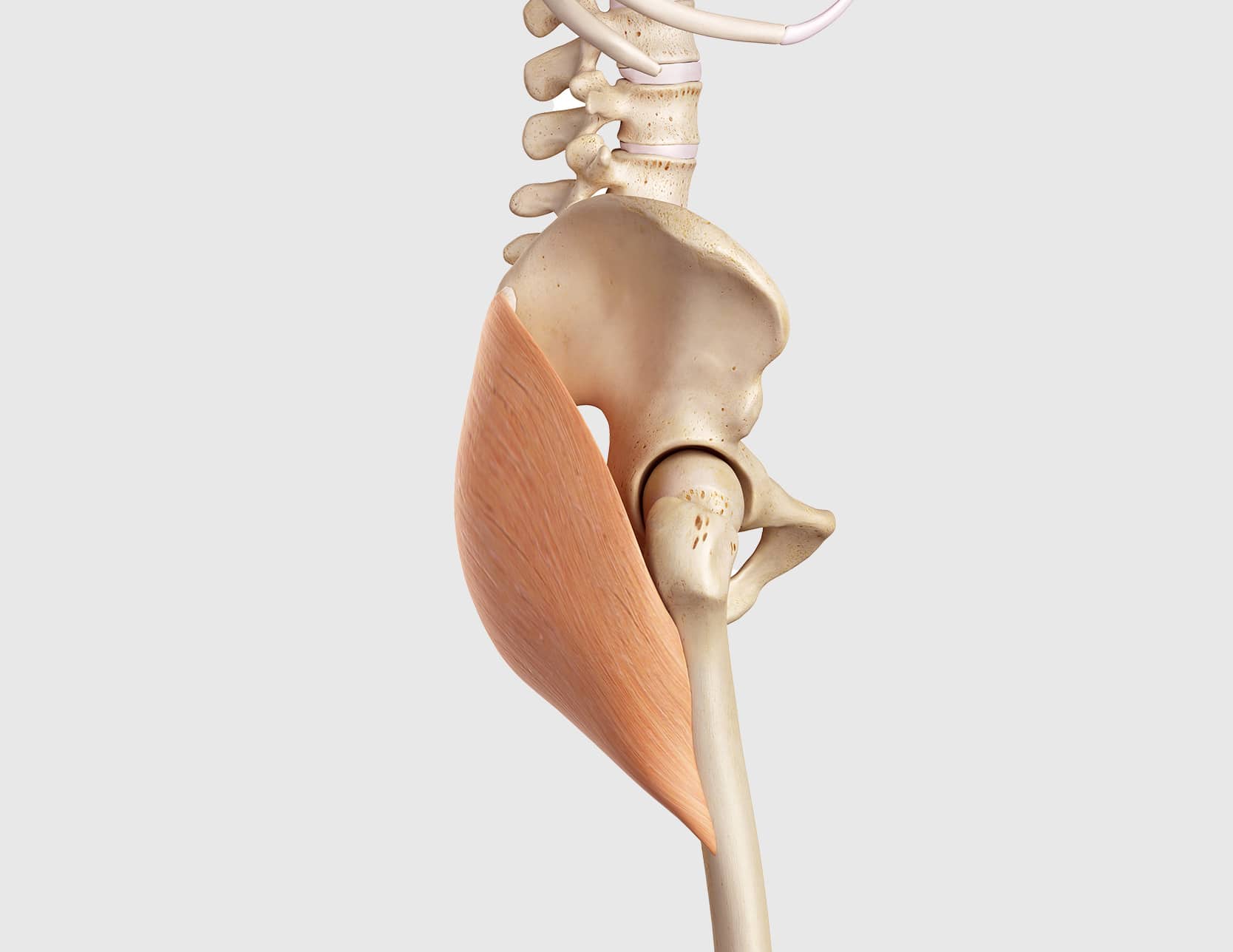 Réparation des tendons du fessier : technique à Paris | Inside the Hip