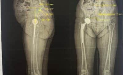 Imagerie EOS et scanner