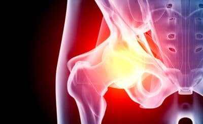 Dancers’ hips wear out prematurely | Paris and Lyon | Inside the Hip